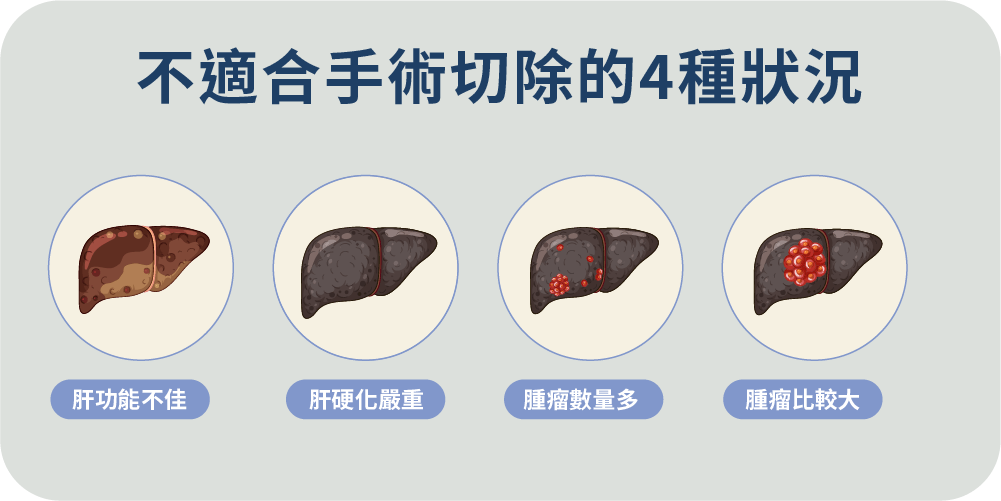 不適合手術切除的4種狀況